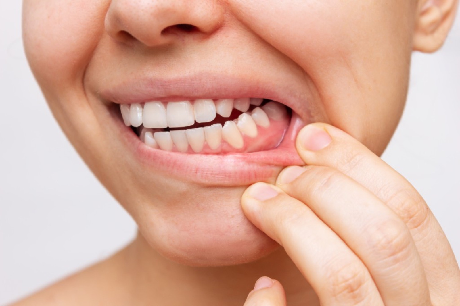 Checking the gum line for periodontal health