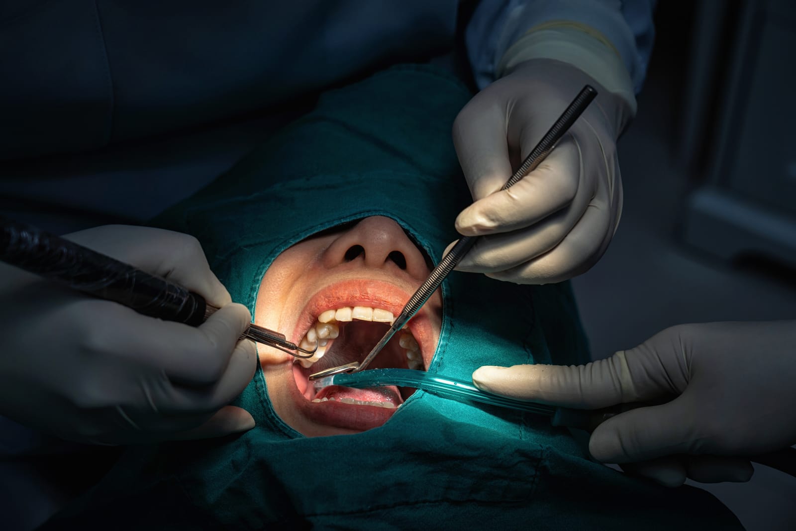 Oral surgery under theatre lighting with sterile drapes